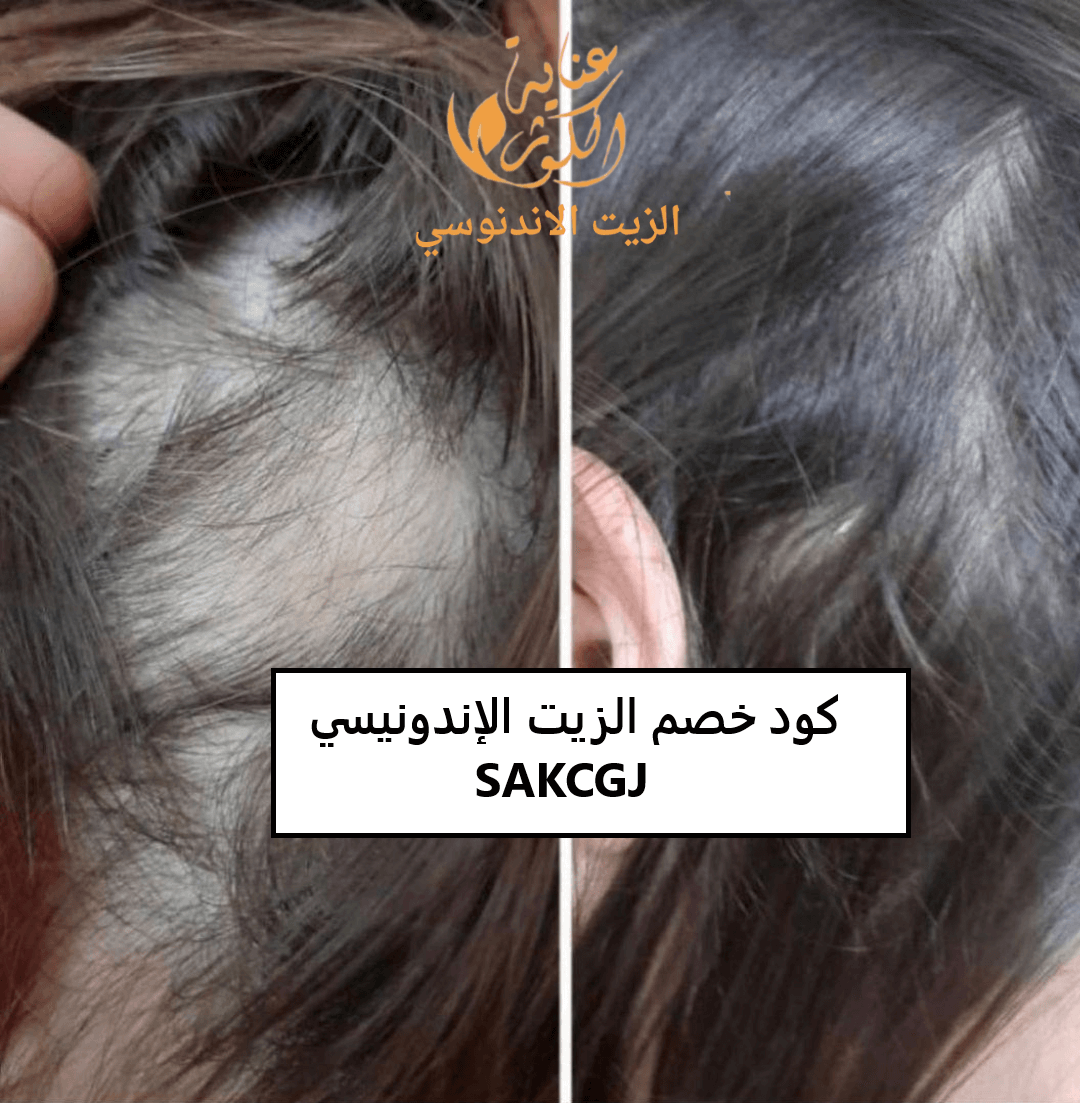كود خصم الزيت الإندونيسي  SAKCGJ